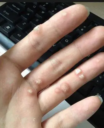 �ൺѰ����ר��ҽԺ