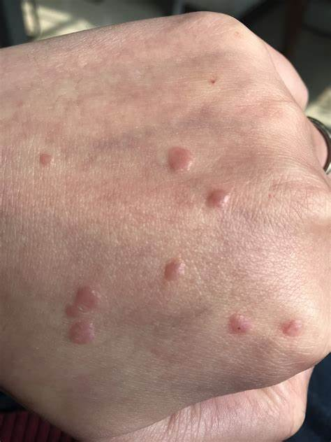 �ൺѰ����ר��ҽԺ