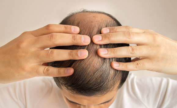 ͺ���ѷ���ʲôԭ����ɵģ�ֲ���޸�������������