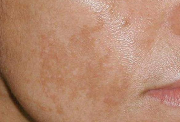 ���ൺ�ƺְ�����ҽԺ���ƺְ�����Щ���õ����Ʒ�����