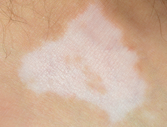 С����Ϊʲô��ð��磿�ҳ�Ӧ�����ϣ����ൺƤ����ҽԺ��